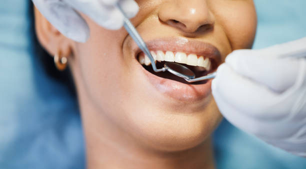 Best Emergency Dental Care for Broken or Chipped Teeth in Avon, OH